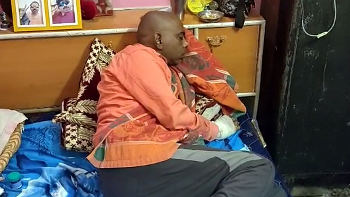 कोरोना से ठीक हुआ तो ब्लैक फंगस से चली गई एक डॉ. के आंख की रोशनी