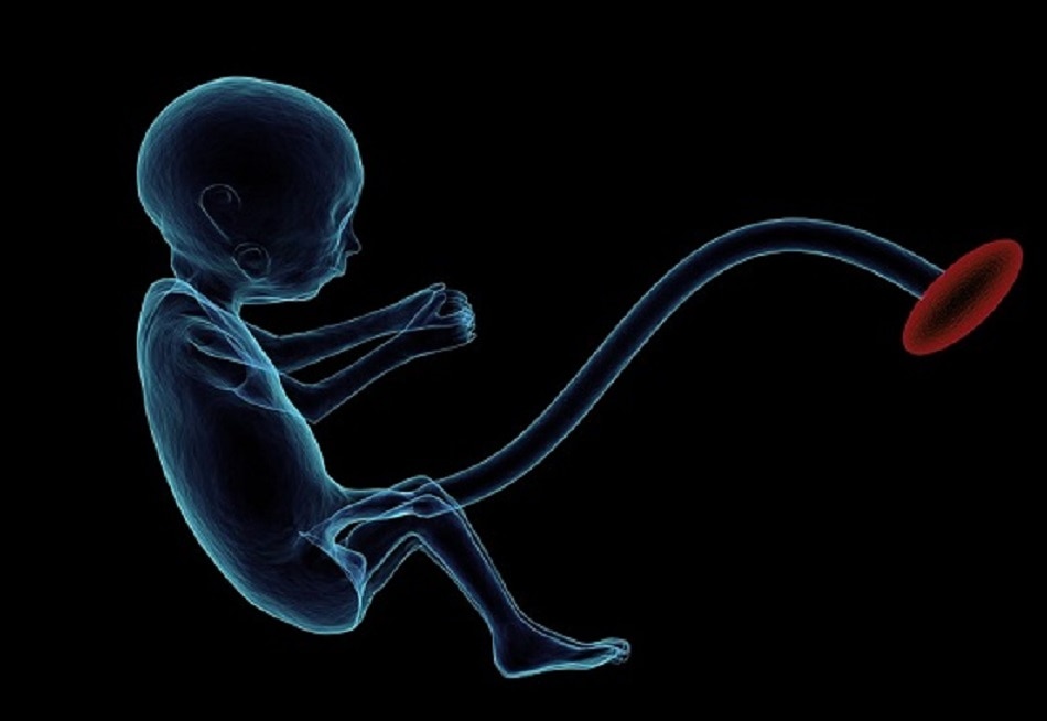 मल्टीपल प्रेग्नेंसी 10