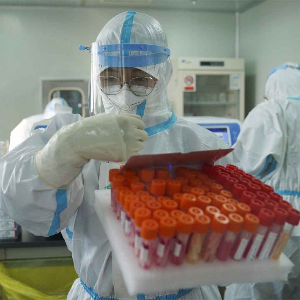 Coronavirus Wuhan lab