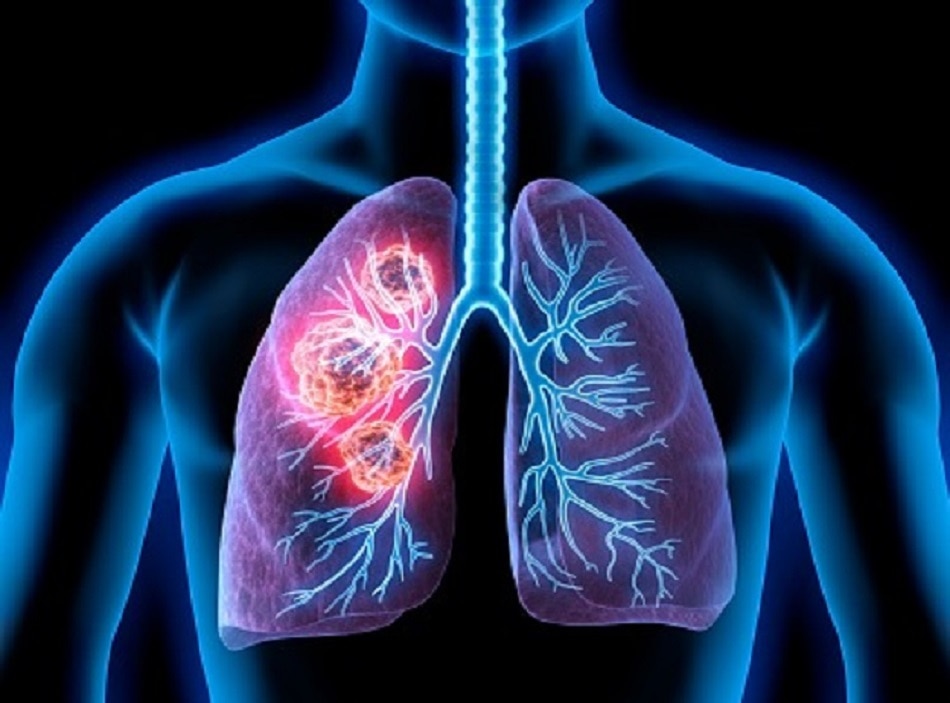 कोरोना वायरस 4