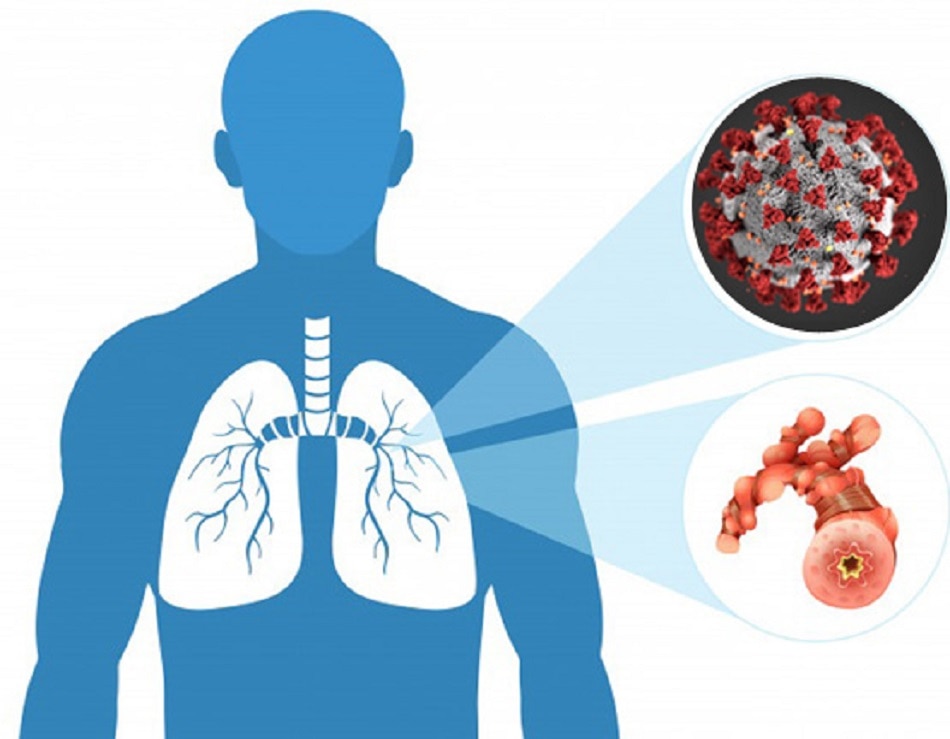 कोरोना वायरस
