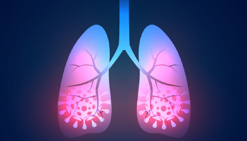 कोरोना वायरस 10