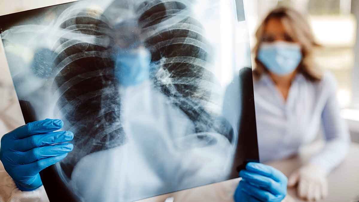 Corona Positive after Recovery