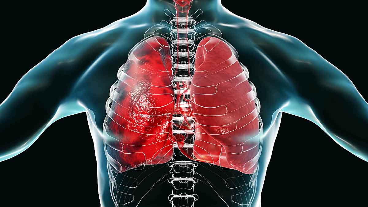 Corona Positive after Recovery