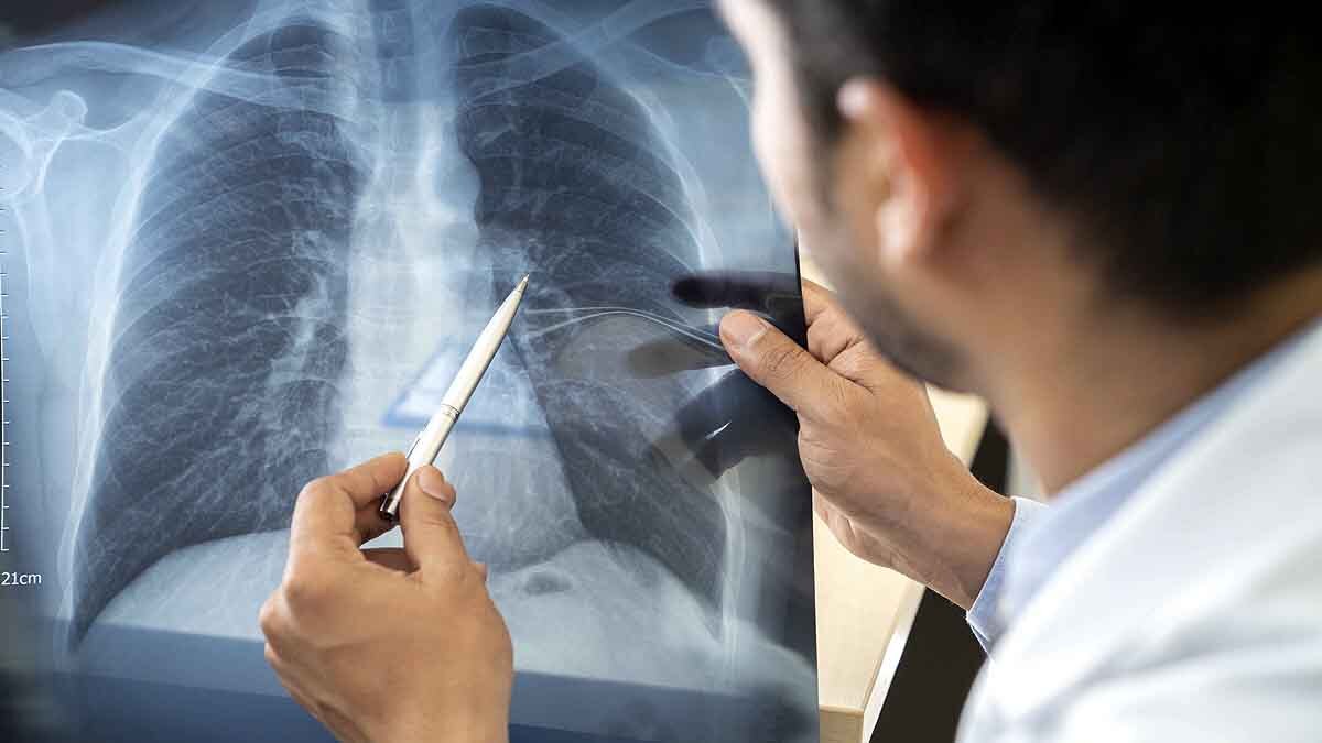 Corona Positive after Recovery