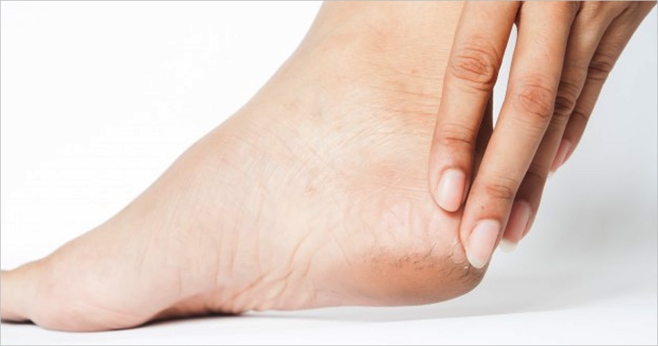 स्किन संबंधी दिक्कतें बढ़ जाती हैं