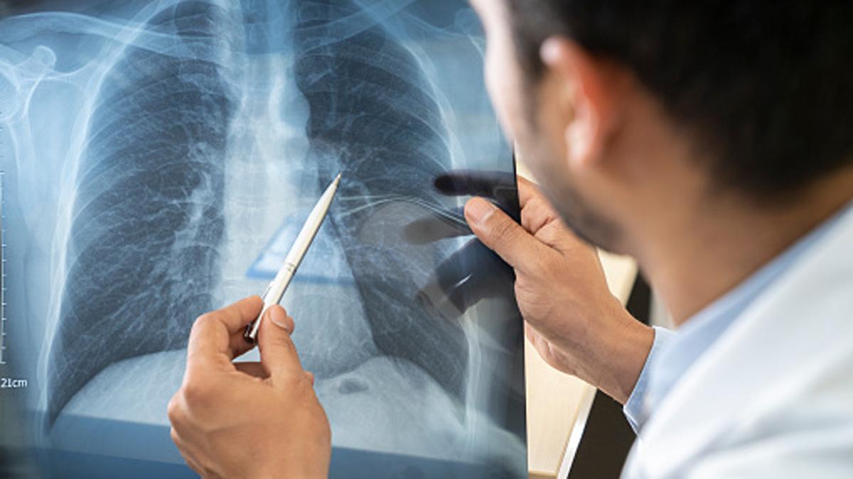 डॉक्टर गुलेरिया के बयान का खंडन 