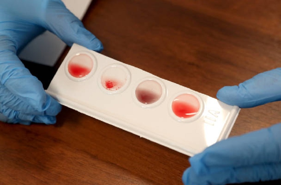 कोरोना वायरस 7