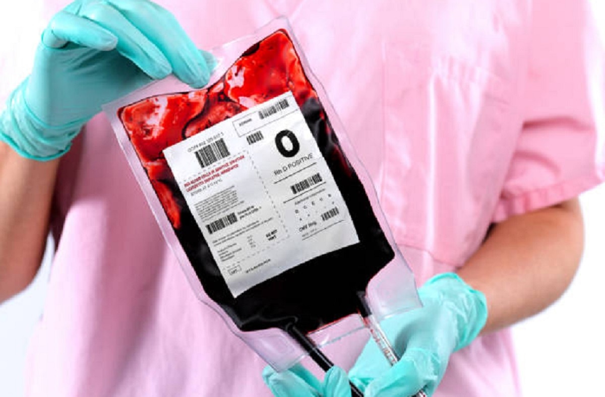 igG एंटीबॉडी टेस्ट