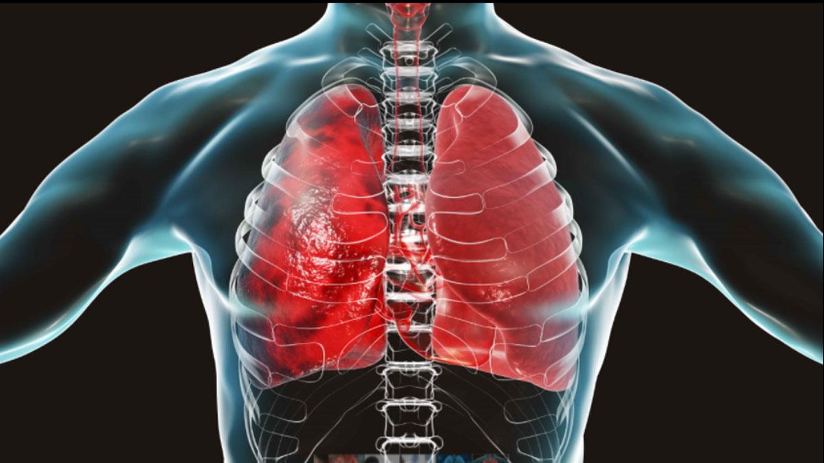 कोरोना कैसे डालता है हमारे फेफड़ों पर असर
