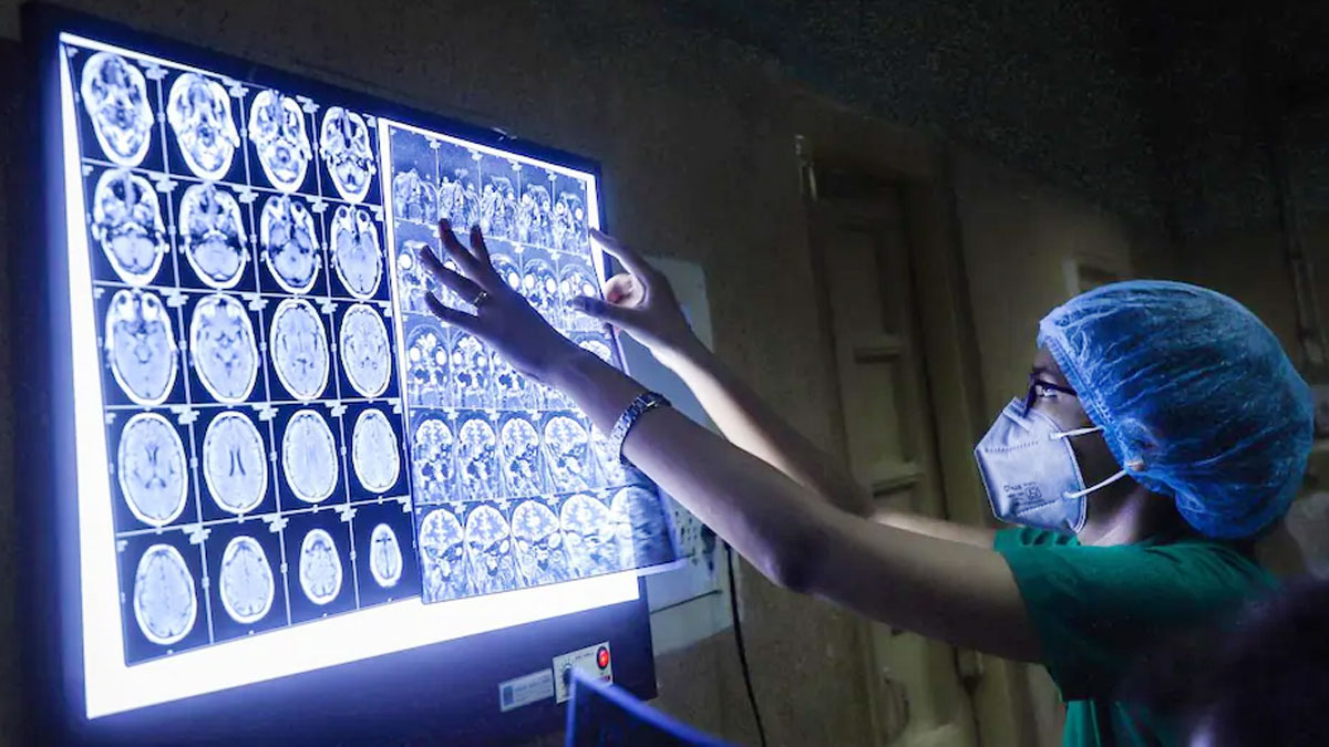 कानपुर में अचानक बढ़ने लगे ब्लैक फंगस के मरीज