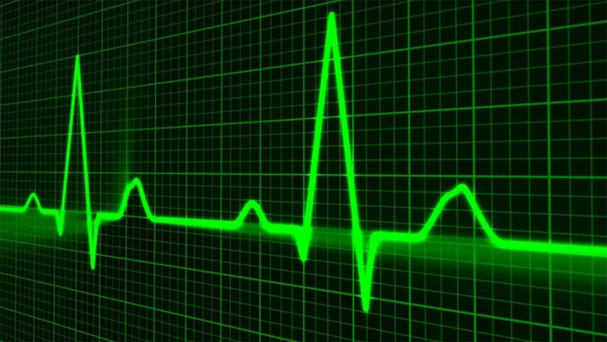 कोरोना के मरीजों में हार्ट अटैक 