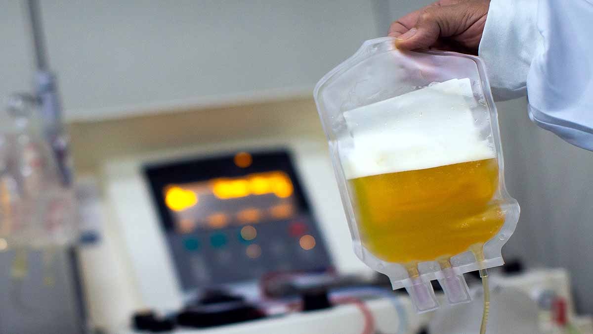 Irrational use of plasma