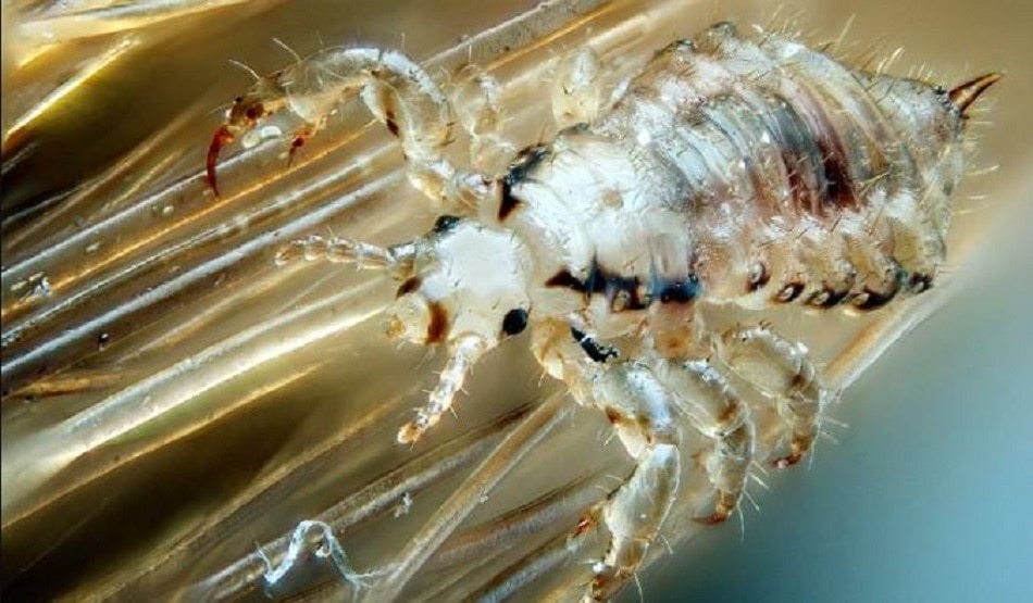 head lice