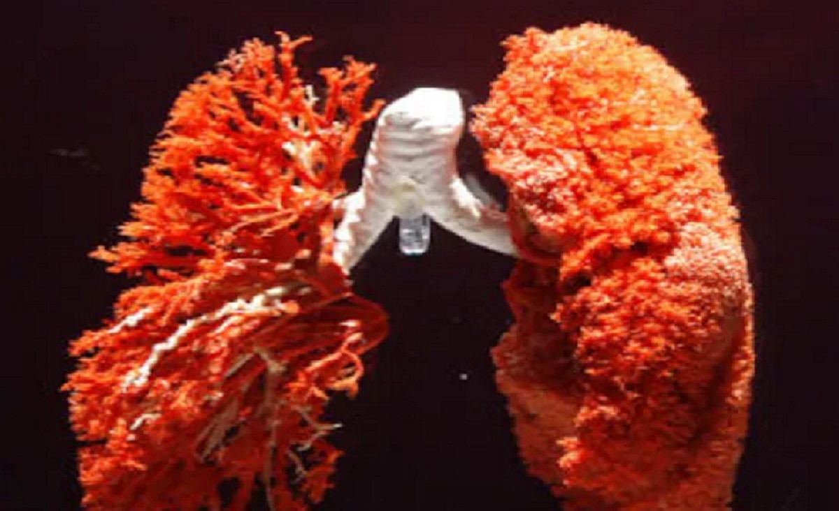 चेस्ट स्कैन