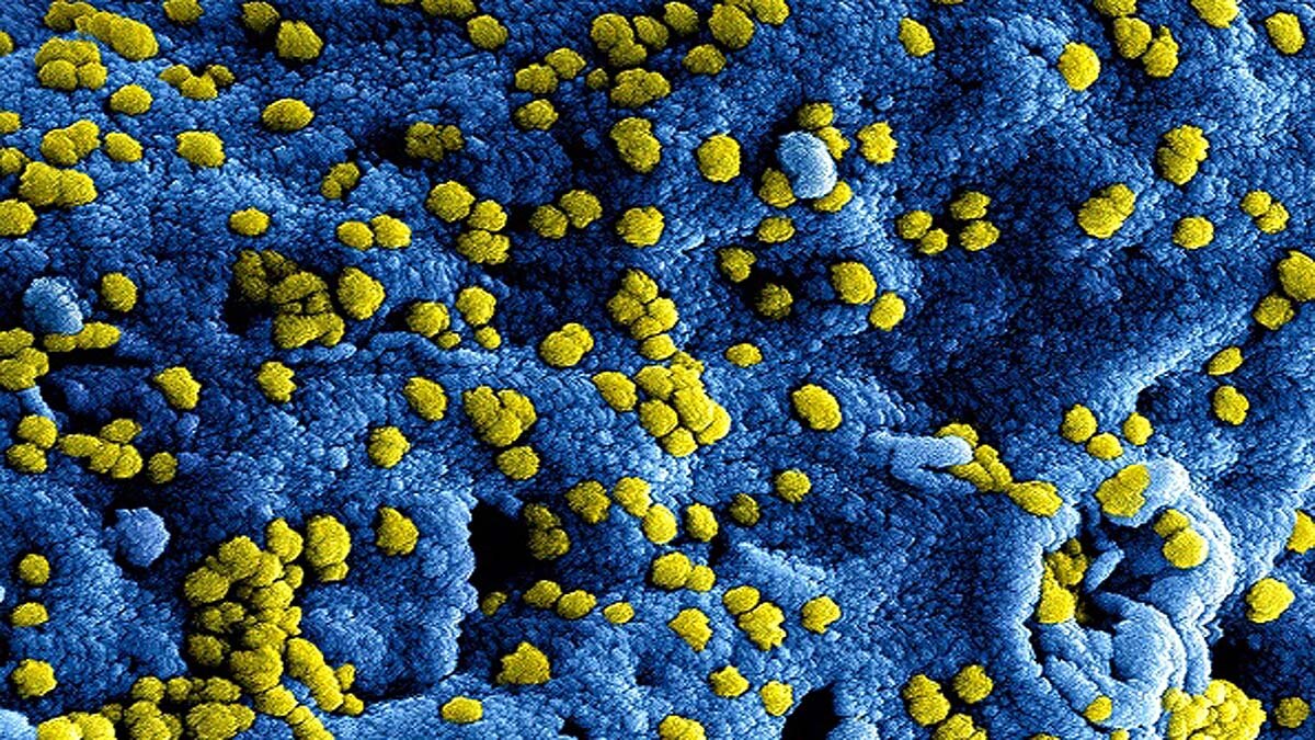 2 new Coronavirus infect People