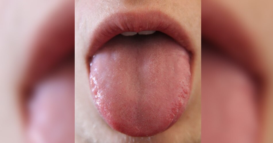 जीभ का रंग