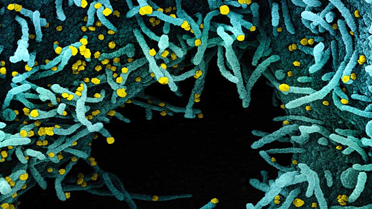 PiN-21 Nanobodies Covid-19 