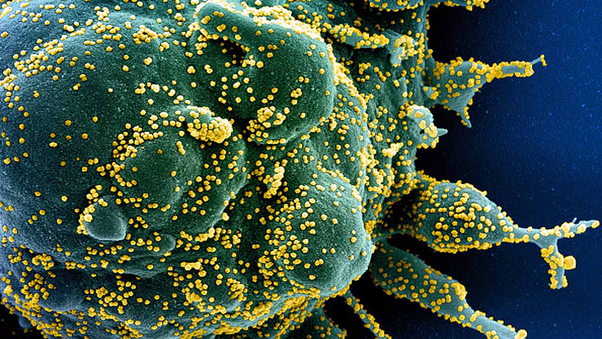 PiN-21 Nanobodies Covid-19 