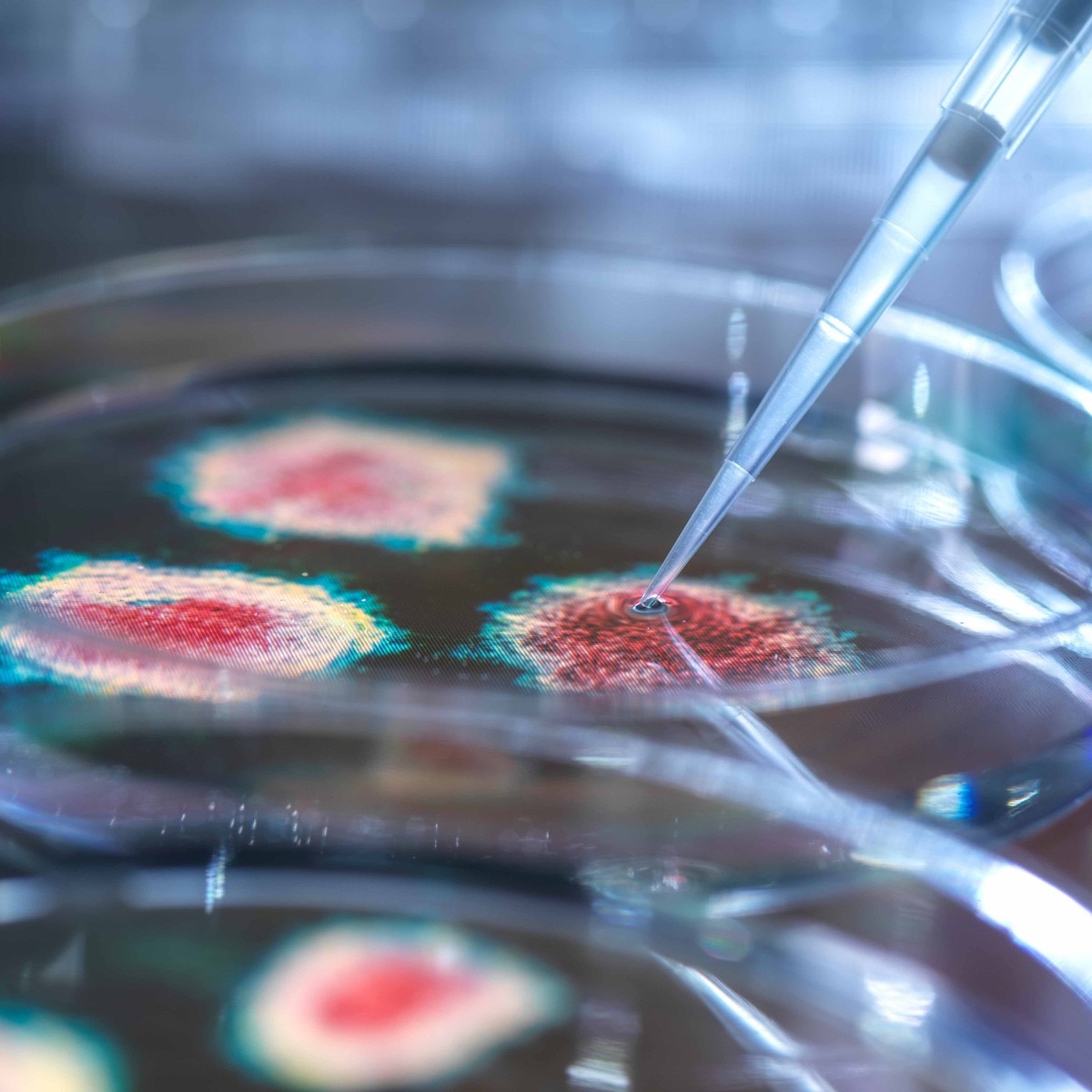 प्रतीकात्‍मक फोटो (Getty)