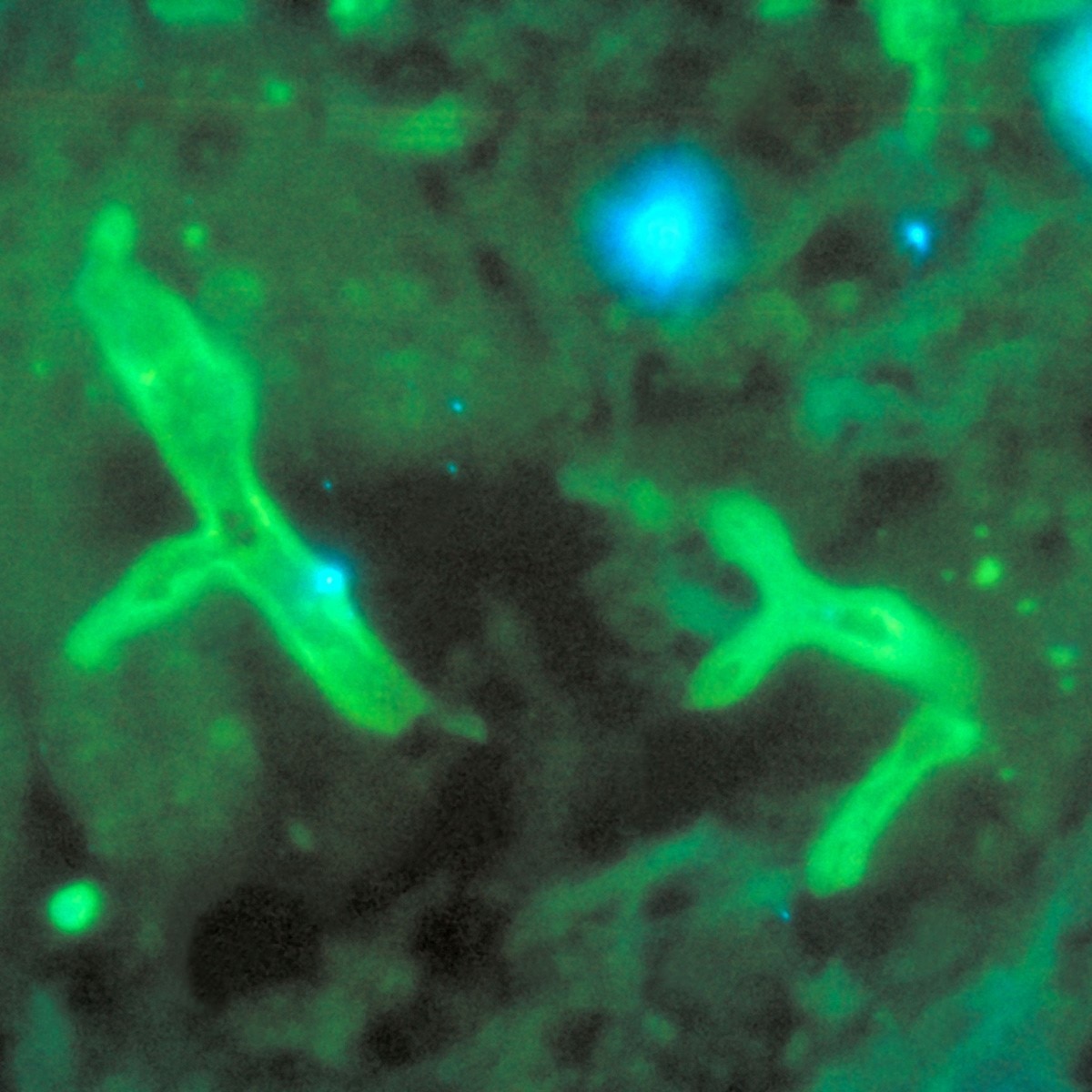 प्रतीकात्मक फोटो (Getty)