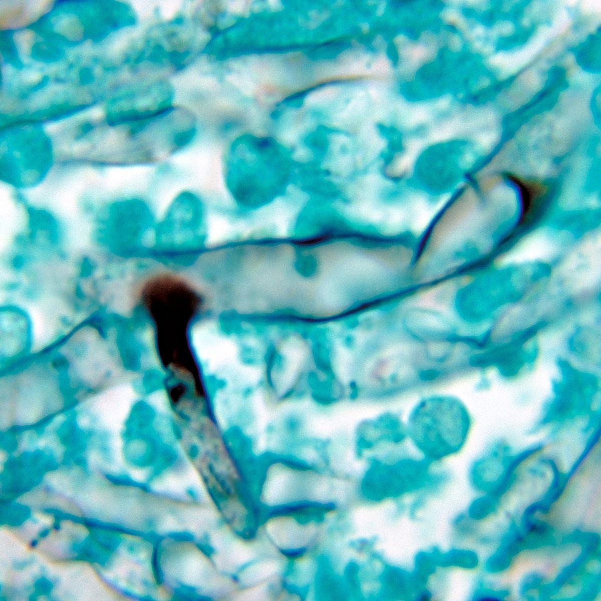 प्रतीकात्मक फोटो (Getty)