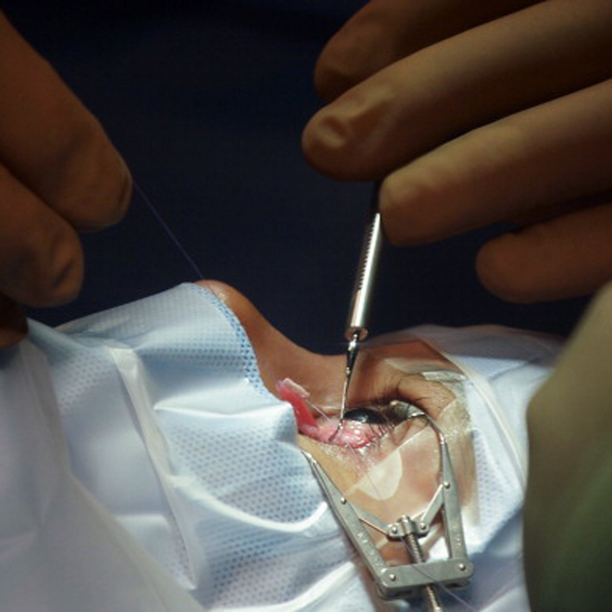 प्रतीकात्मक फोटो (Getty)