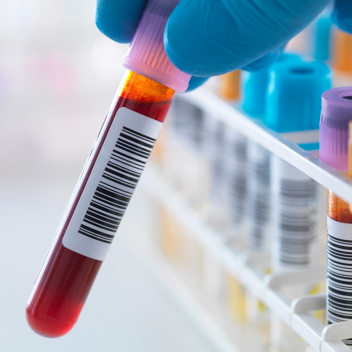 प्रतीकात्‍मक फोटो (Getty)