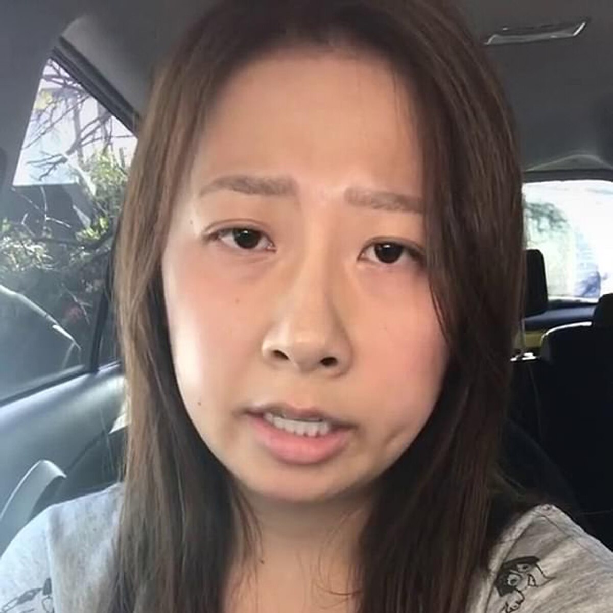 Woman accent change after surgery