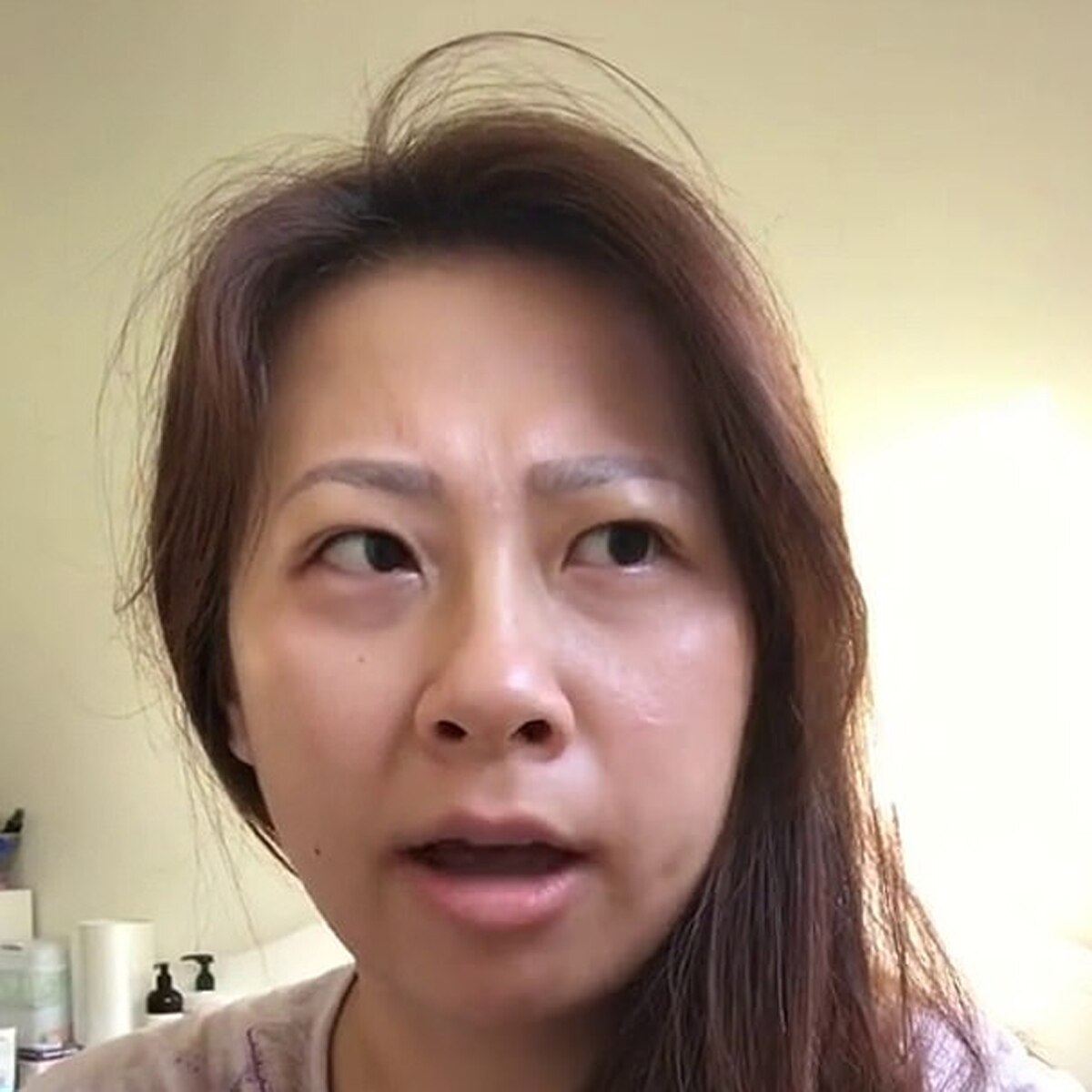 Woman accent change after surgery