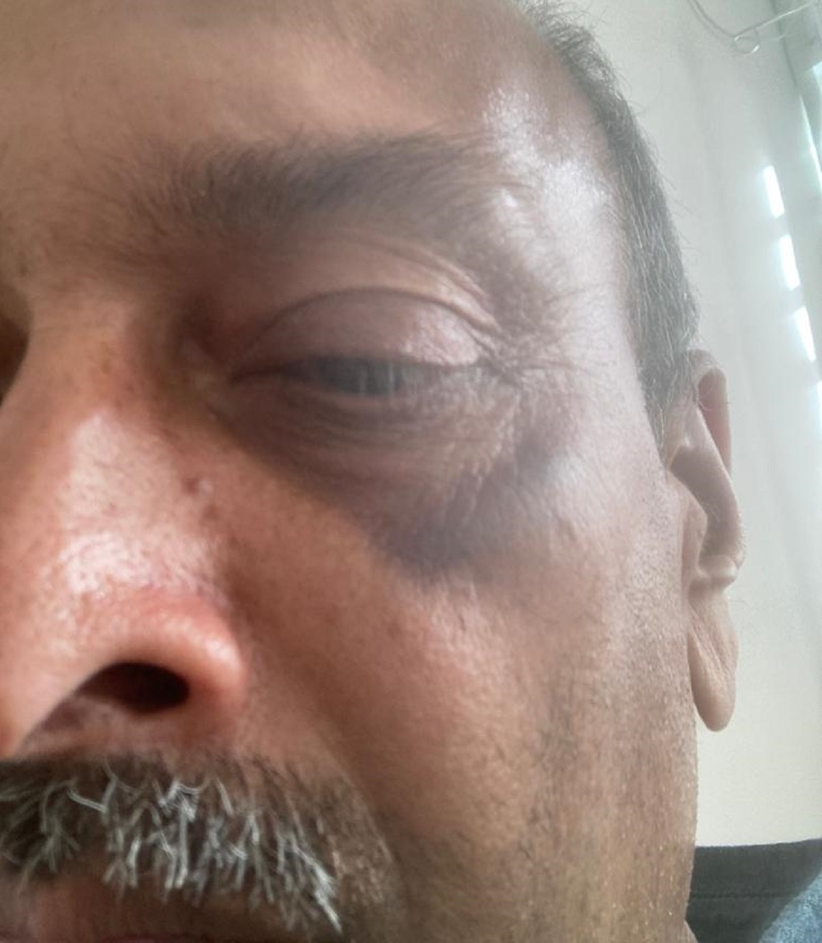 अस्पताल में मेहुल चोकसी