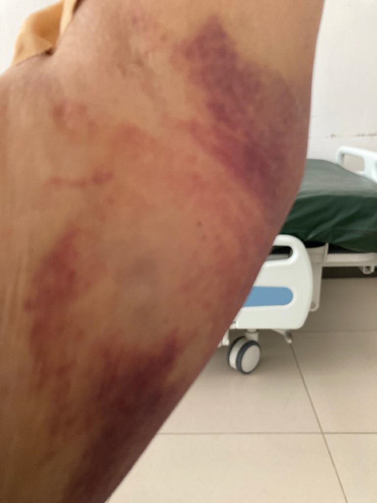 अस्पताल में मेहुल चोकसी