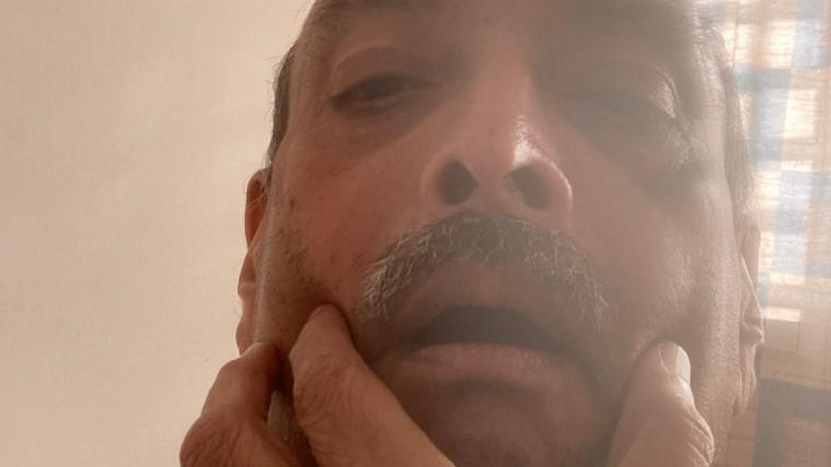 उखड़े नाखून..जिस्म पर घाव, अस्पताल से आईं मेहुल चोकसी की तस्वीरें!