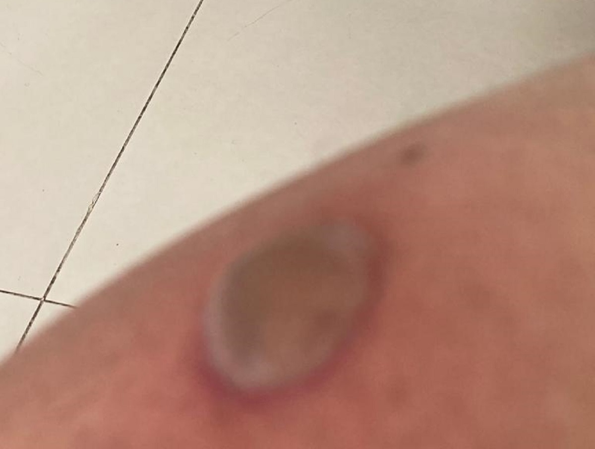 अस्पताल में मेहुल चोकसी