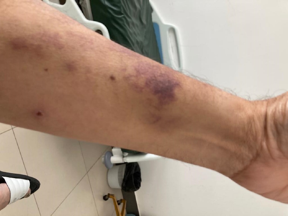 अस्पताल में मेहुल चोकसी