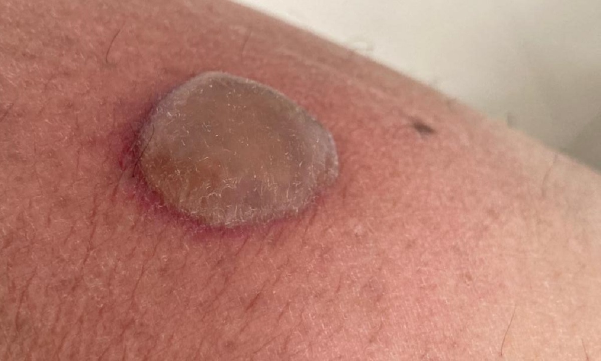 अस्पताल में मेहुल चोकसी