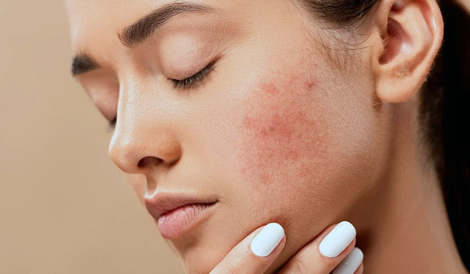 त्वचा की समस्या दूर करे