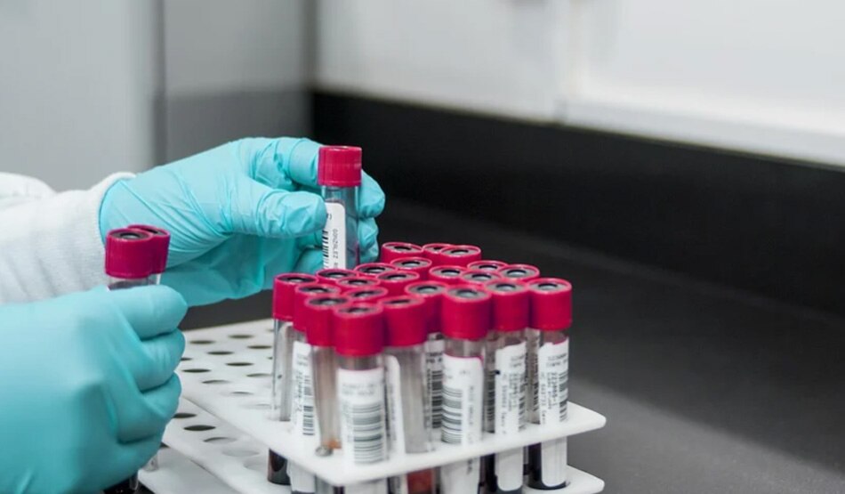 एक्सपर्ट्स5