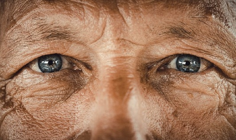 एंटी एजिंग की समस्या