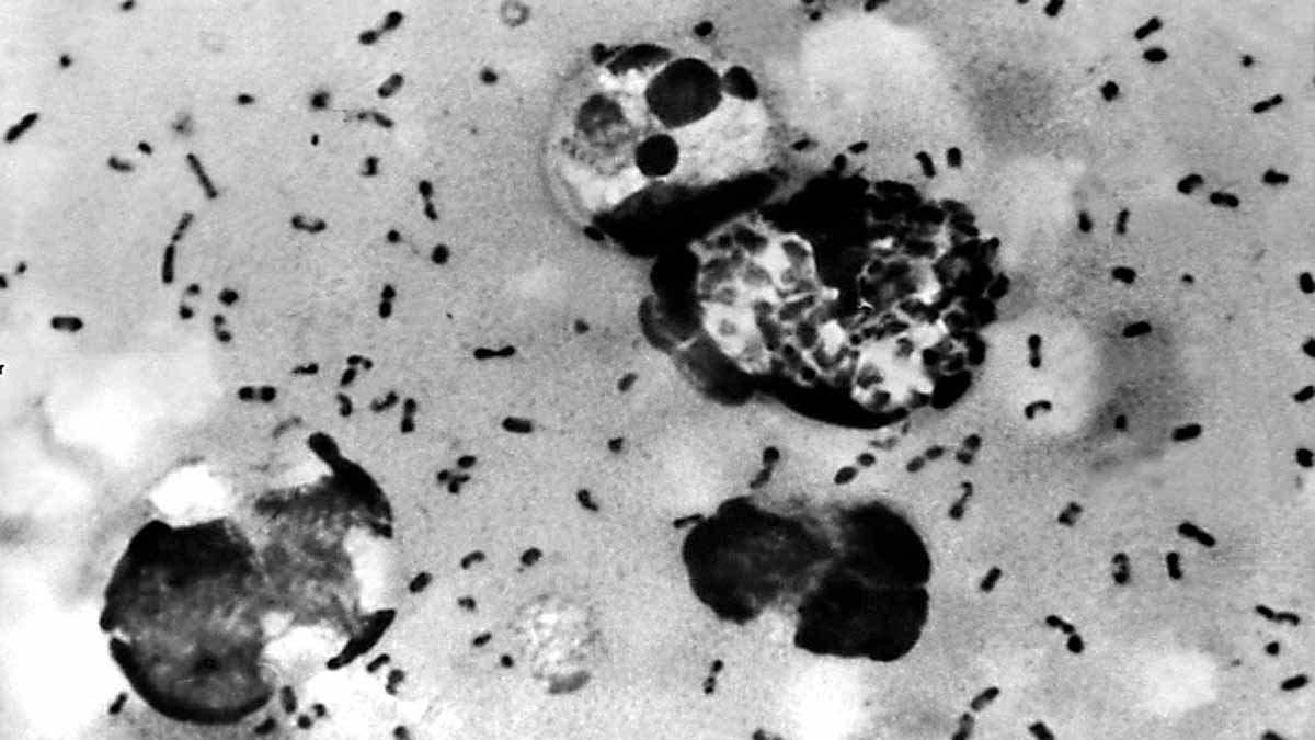 World's Oldest Plague