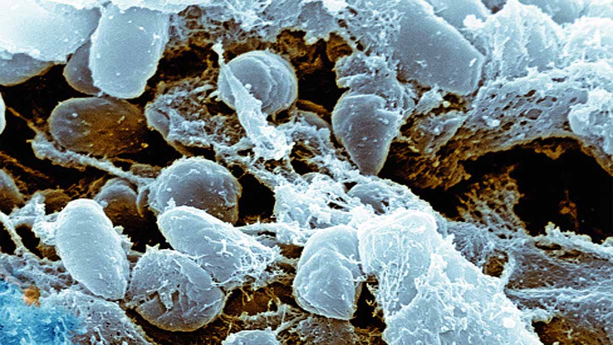 World's Oldest Plague