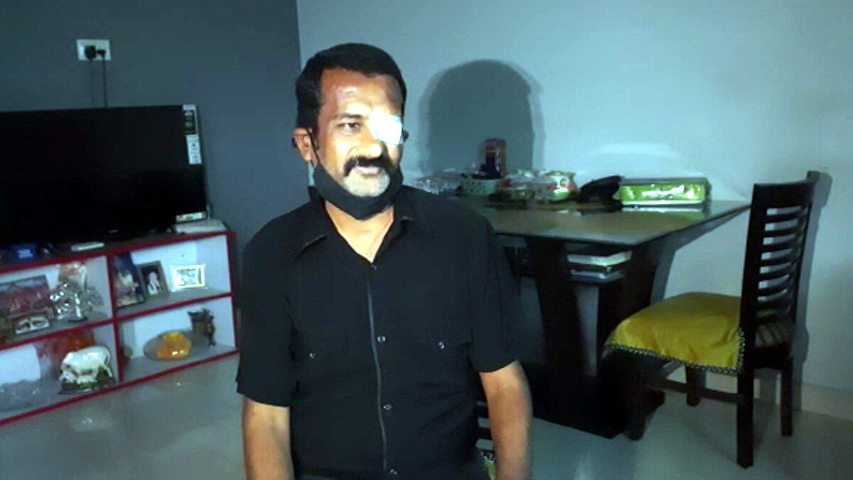 ब्लैक फंगस के इलाज में डेढ़ करोड़ खर्च