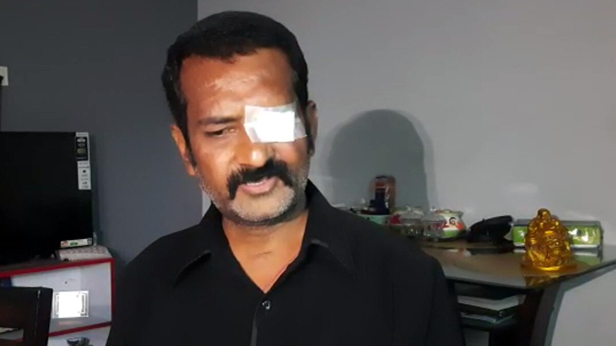 ब्लैक फंगस के इलाज में डेढ़ करोड़ खर्च