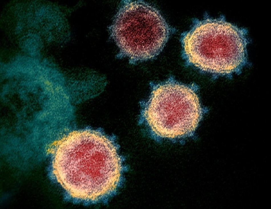 कोरोना के डेल्टा वेरिएंट के लणक्ष