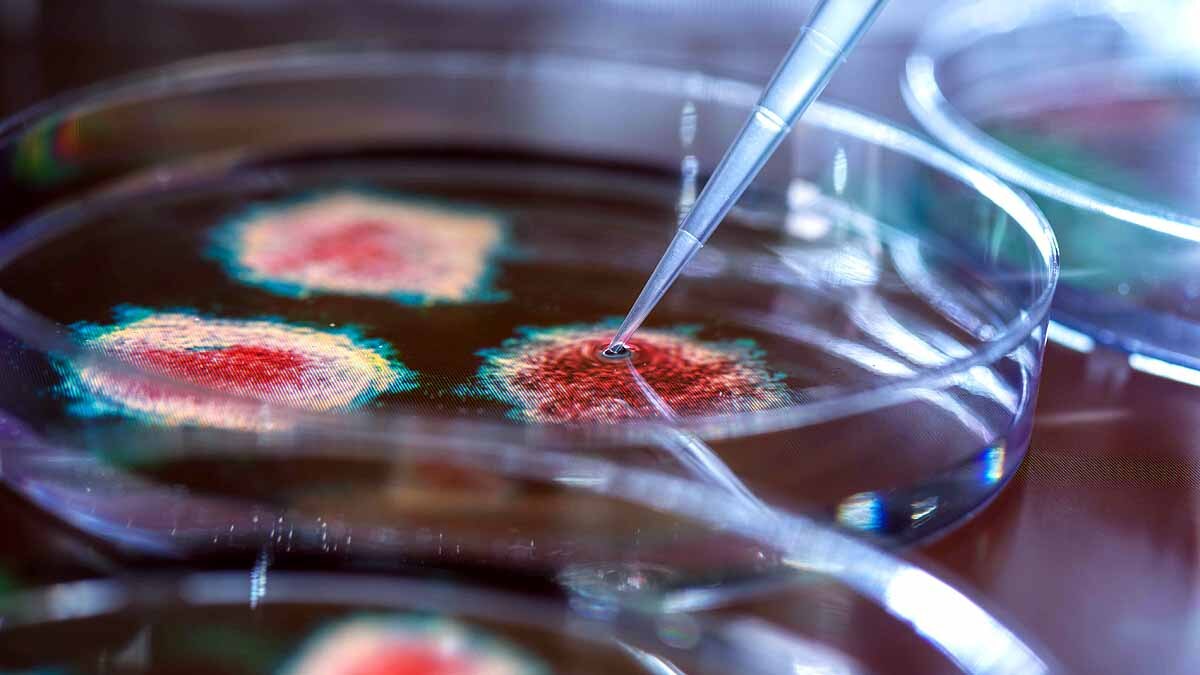 Covid-19 Attack Pancreas Diabetes