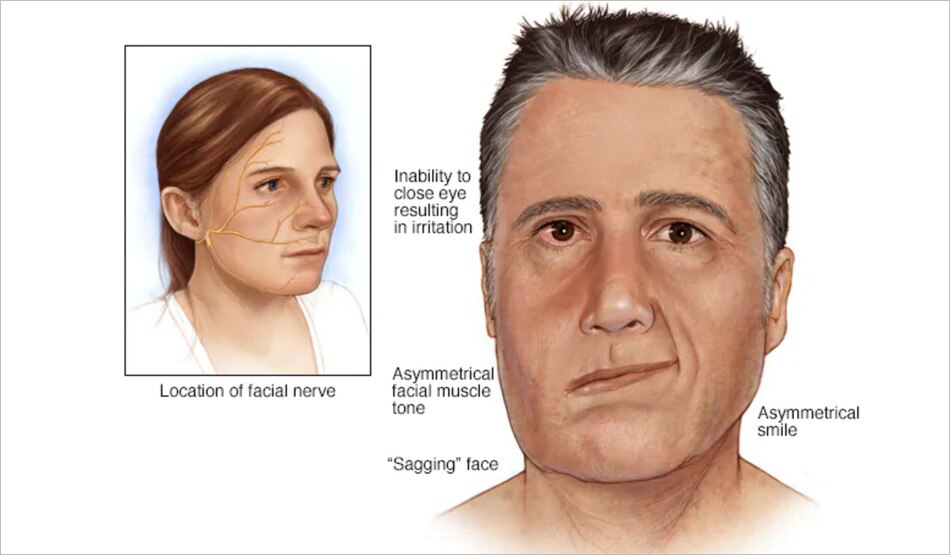 चेहरे की गति को नियंत्रित4,1