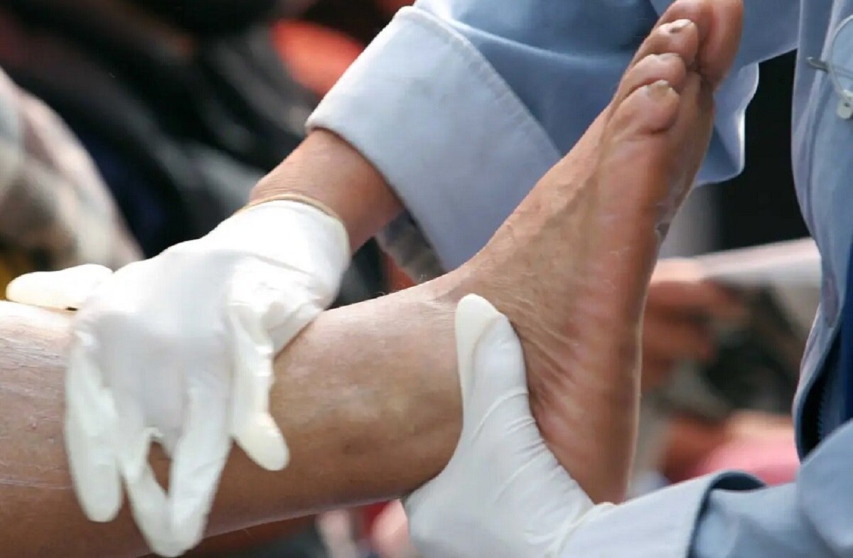 हड्डियों पर असर