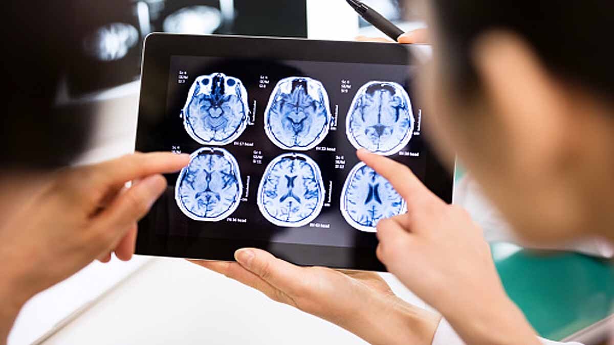 Google Mapped Human Brain