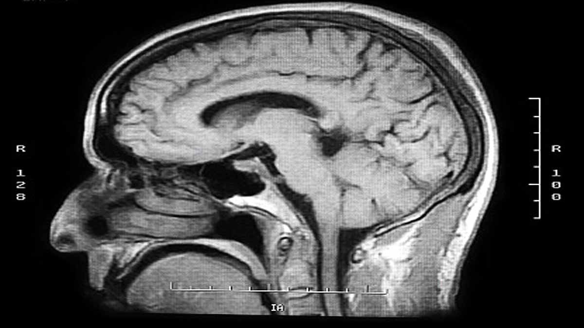 Google Mapped Human Brain