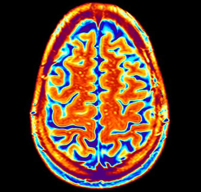Google Mapped Human Brain